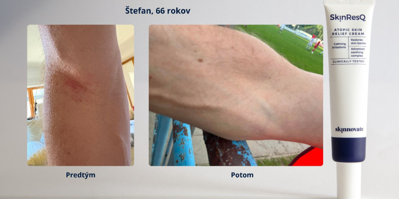 Stefan, 66 r